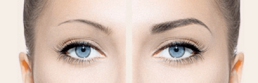 Micropigmentation, or permanent make up, is an innovative cosmetic procedure that enables both men and women to enhance the shape of their eyebrows, hairline, lips, eyes, and more